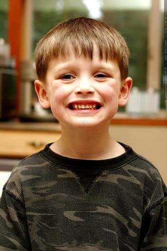 forced smile boy