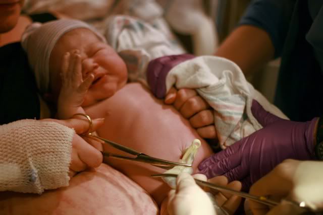 cutting umbilical cord in hospital