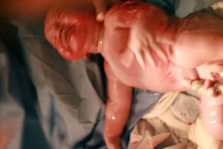 mikko birth — newborn baby all the way out with umbilical cord still attached